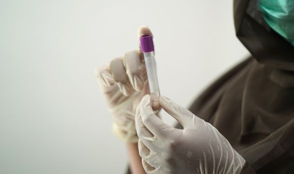 Ispitivanje autoimunih bolesti: Značaj laboratorijskih testova u dijagnostici i praćenju
